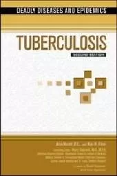 Tuberculosis