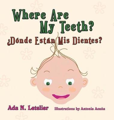 Where Are My Teeth?  d nde Est n MIS Dientes?