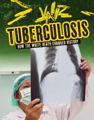 Tuberculosis: How the White Death Changed History