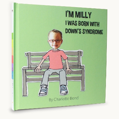 I was born with down's syndrom