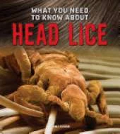 What You Need to Know about Head Lice