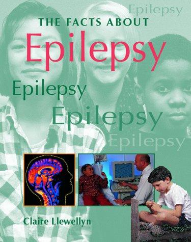 FACTS ABOUT EPILEPSY