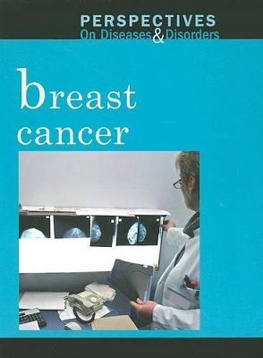 Breast Cancer