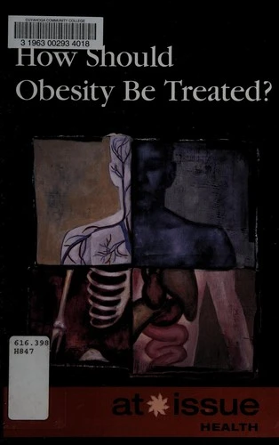 How Should Obesity Be Treated?