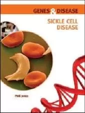 Sickle Cell Disease