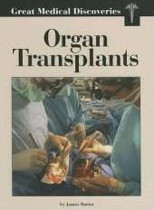 Organ Transplants