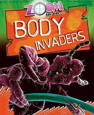 Zoom in On: Body Bugs