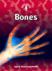Bones