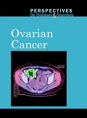 Ovarian Cancer