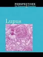 Lupus
