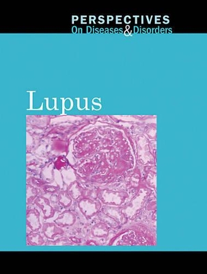 Lupus