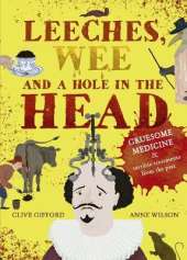 Leeches, Wee and a Hole in the Head: Gruesome medicine and terrible treatments from the past
