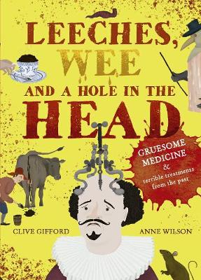Leeches, Wee and a Hole in the Head: Gruesome medicine and terrible treatments from the past