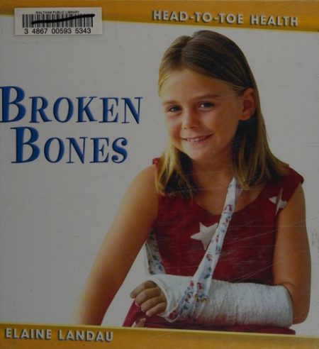 Broken Bones