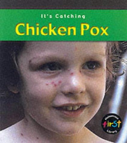 It's Catching: Chicken Pox Paperback