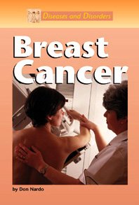 Breast Cancer