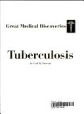 Tuberculosis